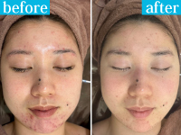 肌の根本から整え、憧れの陶器肌へ。確かな変化が多くのお客様から支持されています。