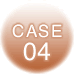 CASE04