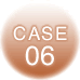 CASE06