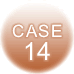 case14